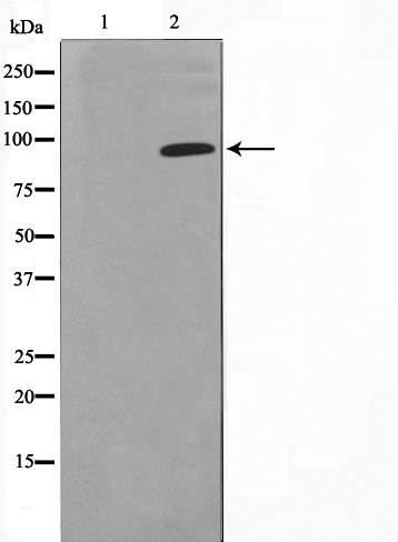 Glucocorticoid receptor Ab