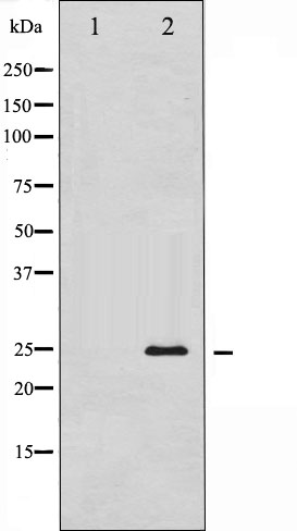 Thymidine kinase Ab