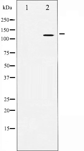 Amyloid beta A4 Ab