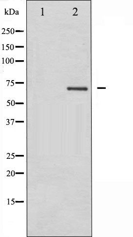 PKC beta Ab