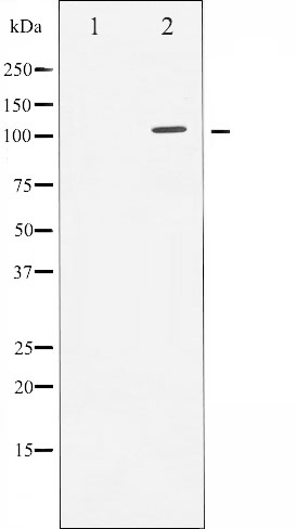 Androgen receptor Ab