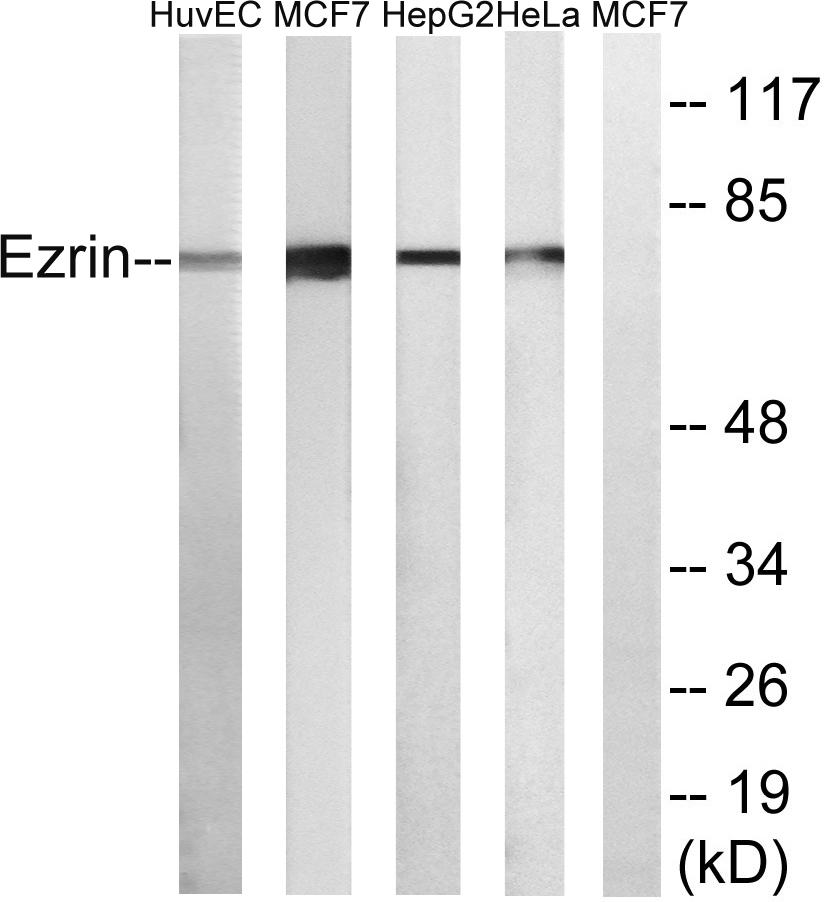 Ezrin Ab