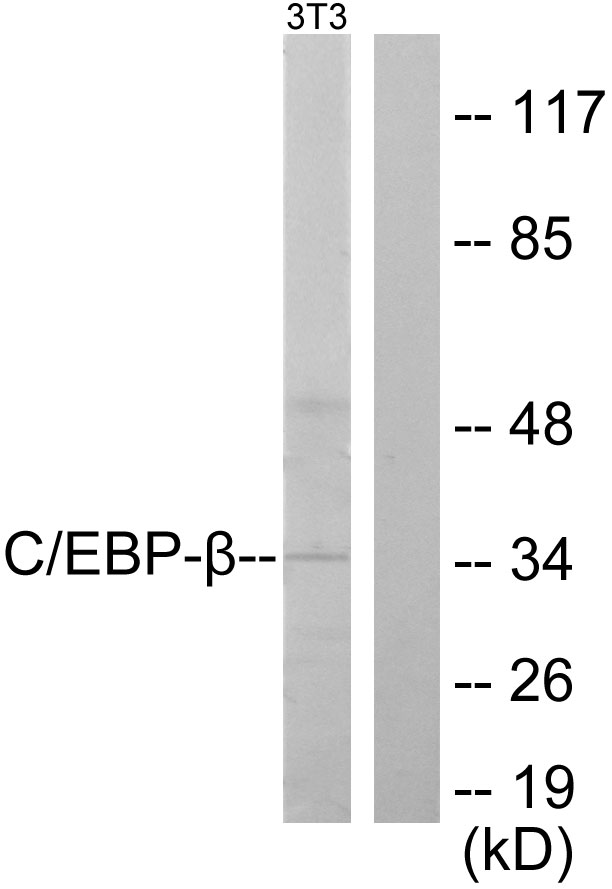 CEBP beta Ab