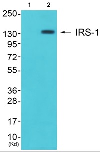 IRS 1 Ab