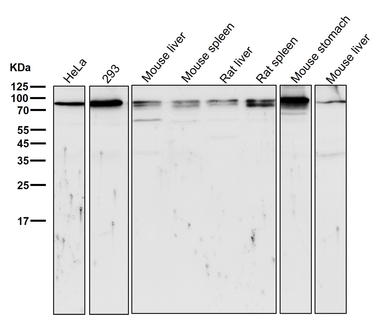 beta Catenin Ab