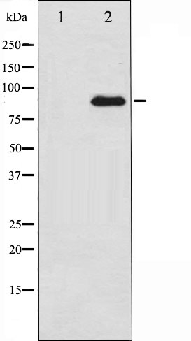 GluN1 Ab