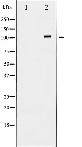 GluN1 Ab