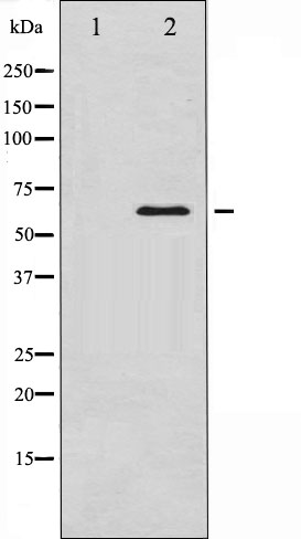 SMAD1 Ab