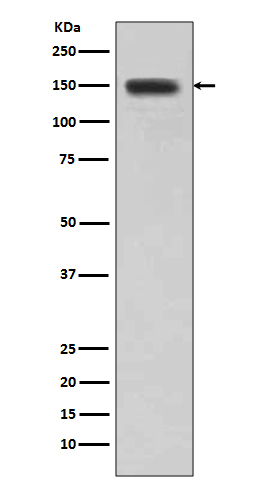 Desmoglein 1 Ab