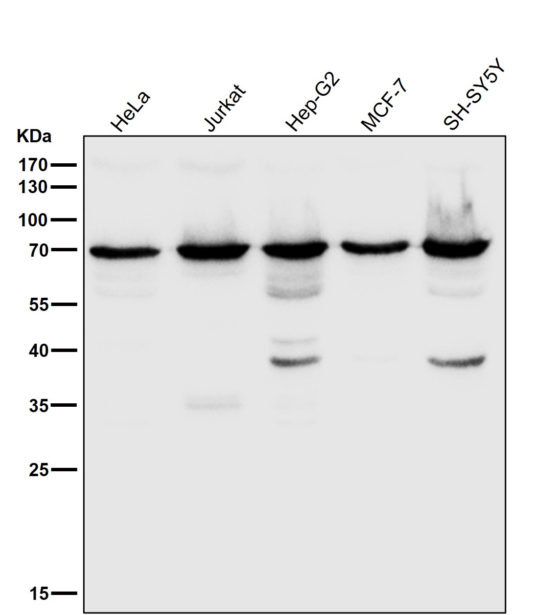 KIFC1 Ab