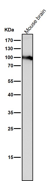 DNMT3B Ab