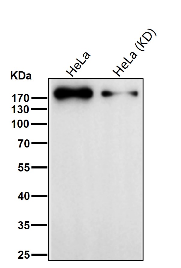 Topoisomerase 2 alpha Ab