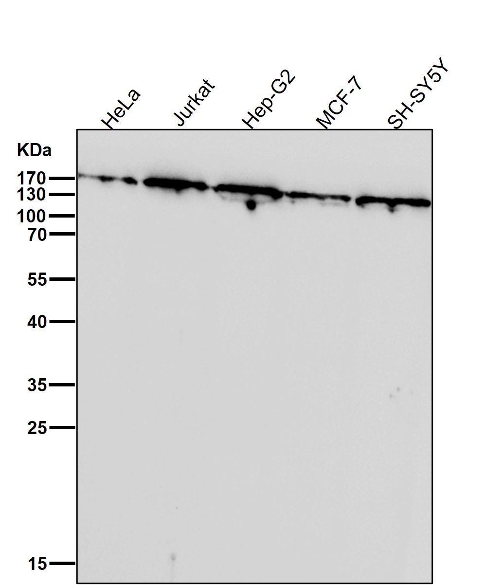 Topoisomerase 2 alpha Ab