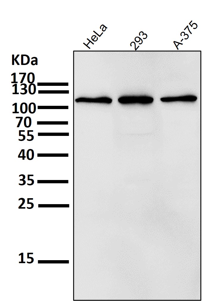 RNF20 Ab