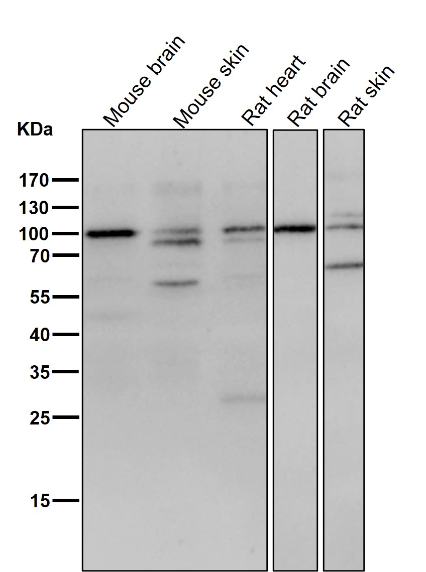 delta Catenin Ab