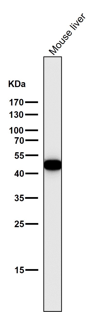 Cytokeratin 18 Ab