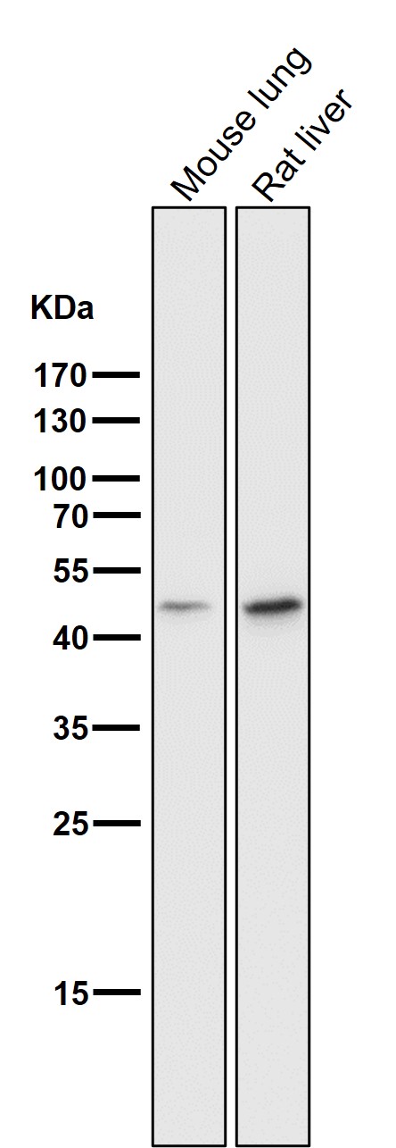 Cytokeratin 18 Ab