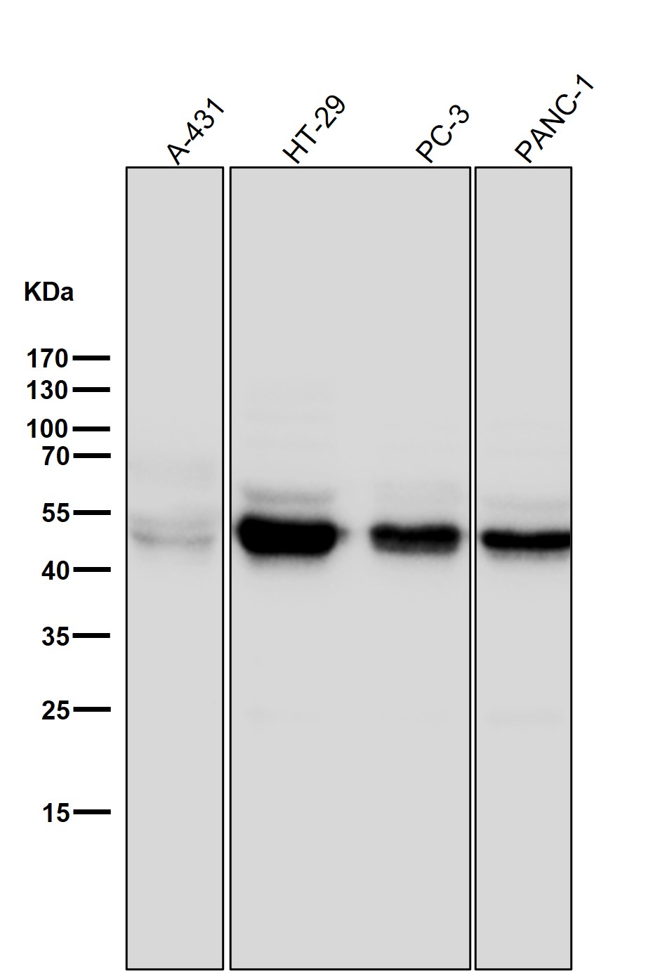 Cytokeratin 18 Ab