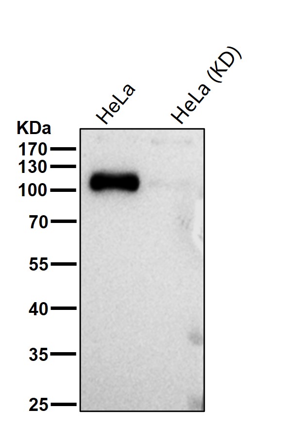 Androgen receptor Ab