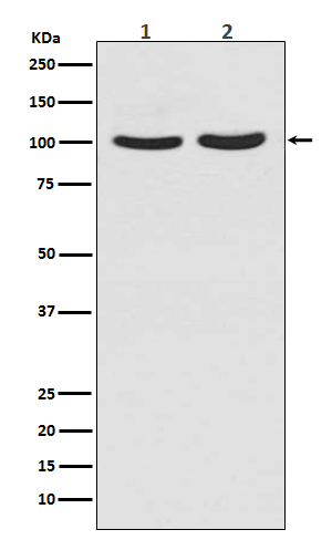 Androgen receptor Ab