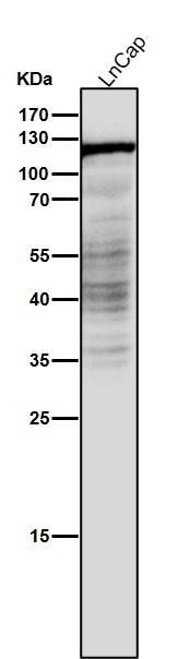 Androgen receptor Ab