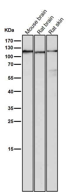 Androgen receptor Ab