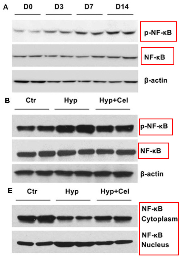 NF-kB p65 Ab