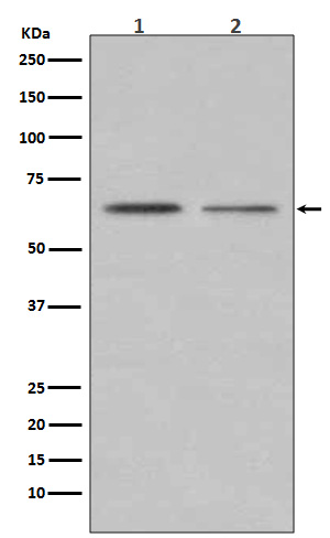 Estrogen receptor Ab