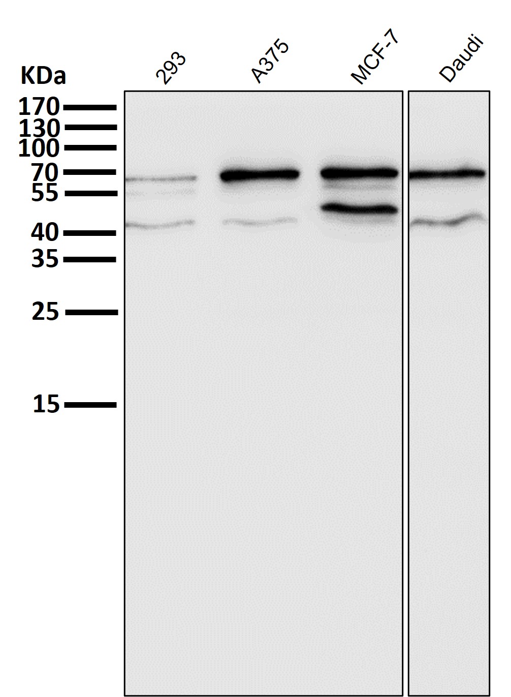 Estrogen receptor Ab