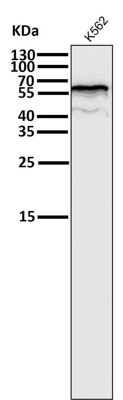 Estrogen receptor Ab