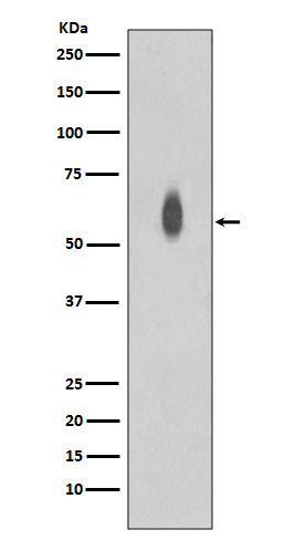 p-c Myc (T58/S62) Ab