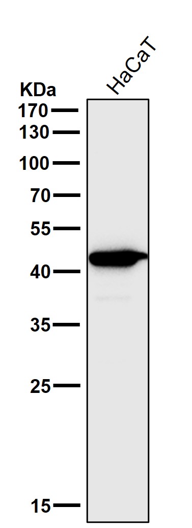 CCR2 Ab