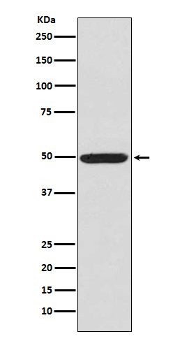 p-PRKAR2A (S99) Ab