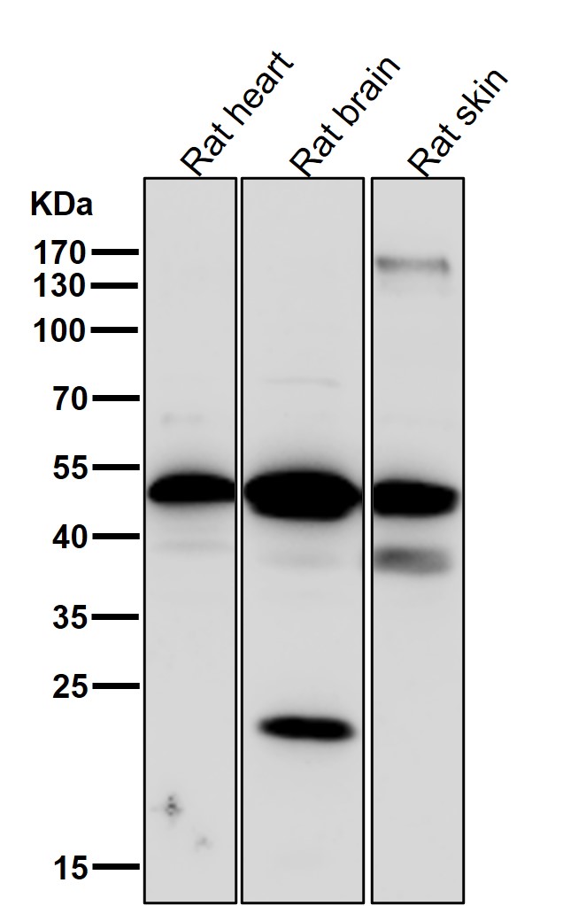 p-PRKAR2A (S99) Ab