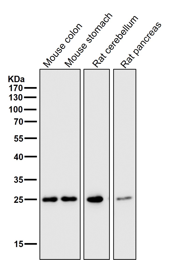 HMGB1 Ab