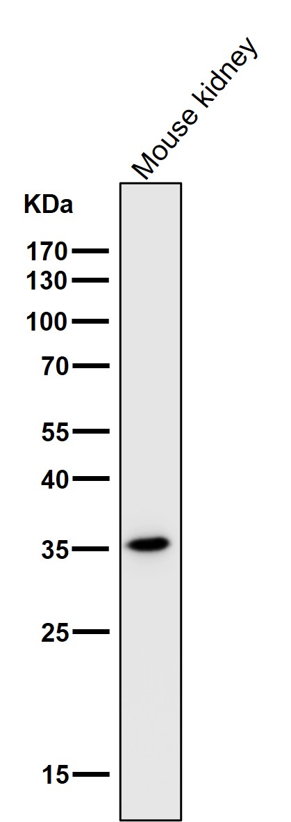 HMGB1 Ab