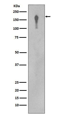 EGFR Ab