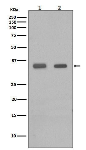 CEBP beta Ab