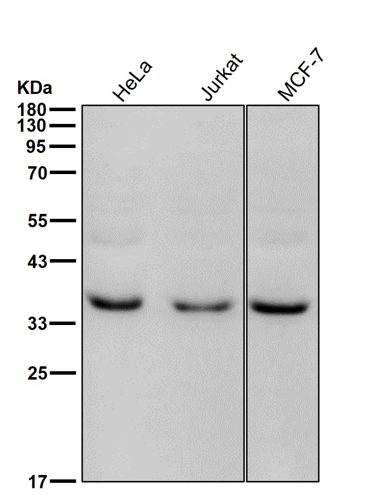 CEBP beta Ab