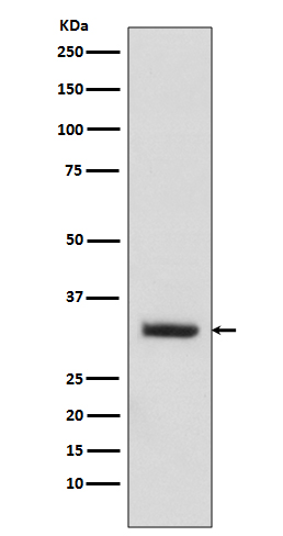 Enkurin Ab