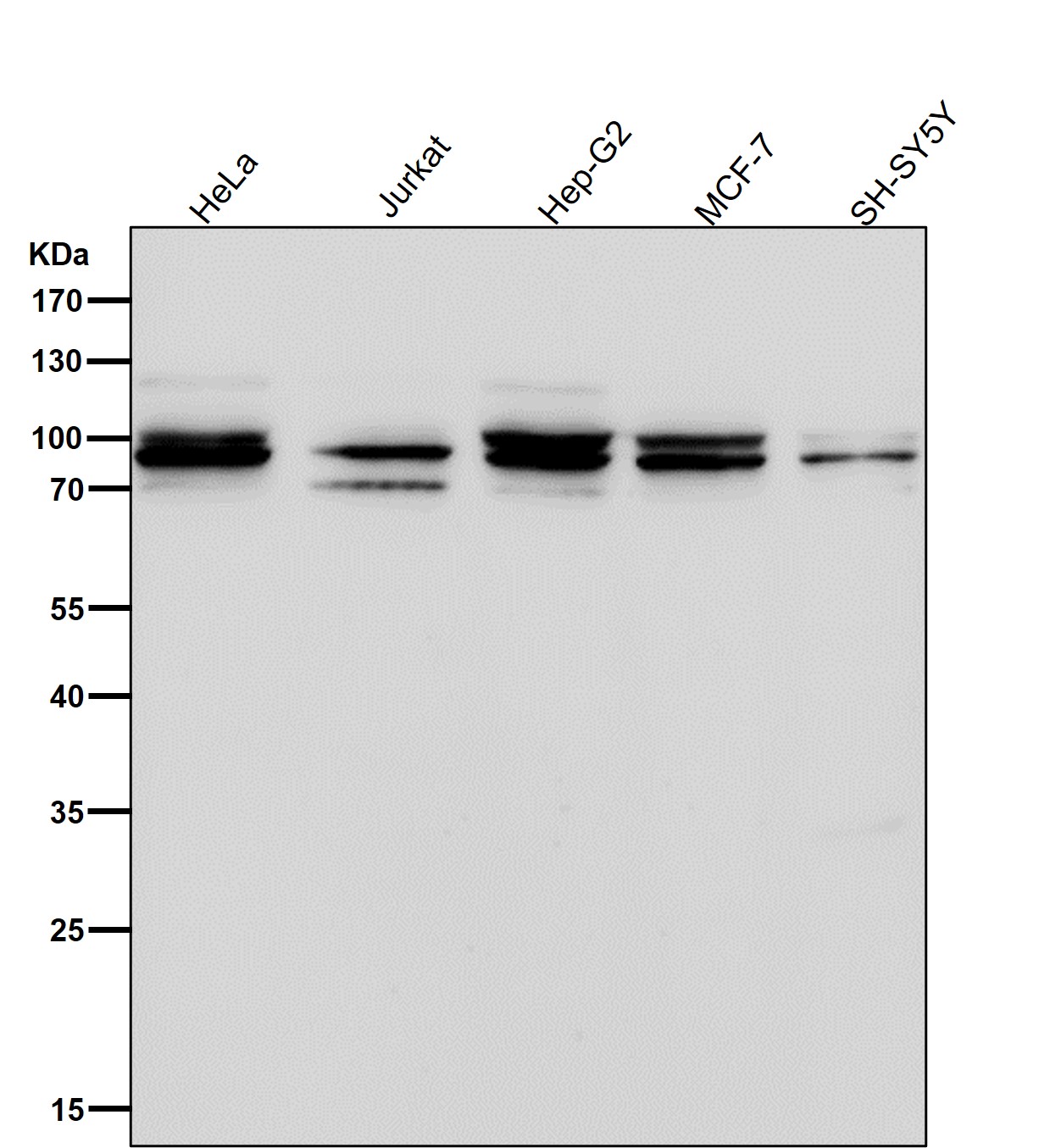 Aconitase 1 Ab