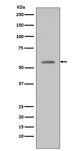 p-p53 (S33) Ab