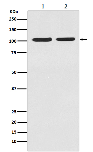 HIF 2 alpha Ab