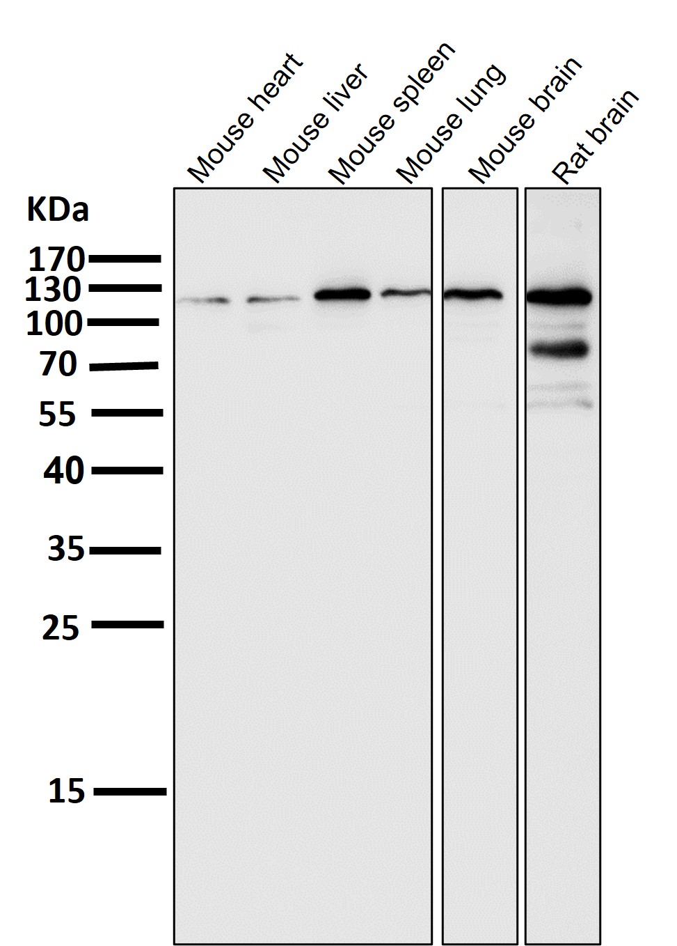 HIF 2 alpha Ab