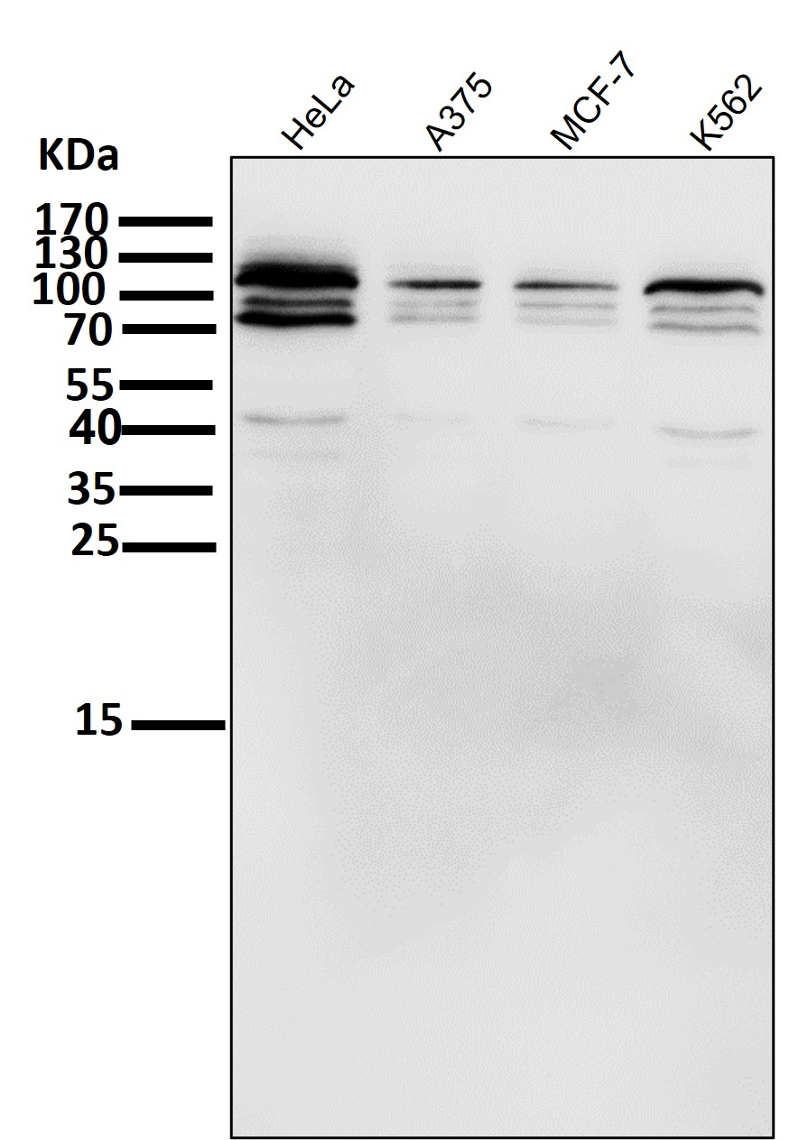 HIF 2 alpha Ab