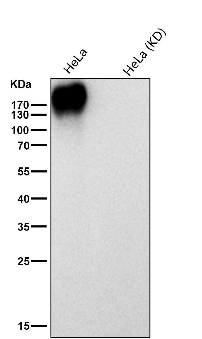 EGFR Ab