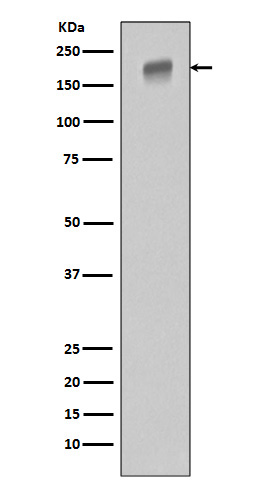 EGFR Ab