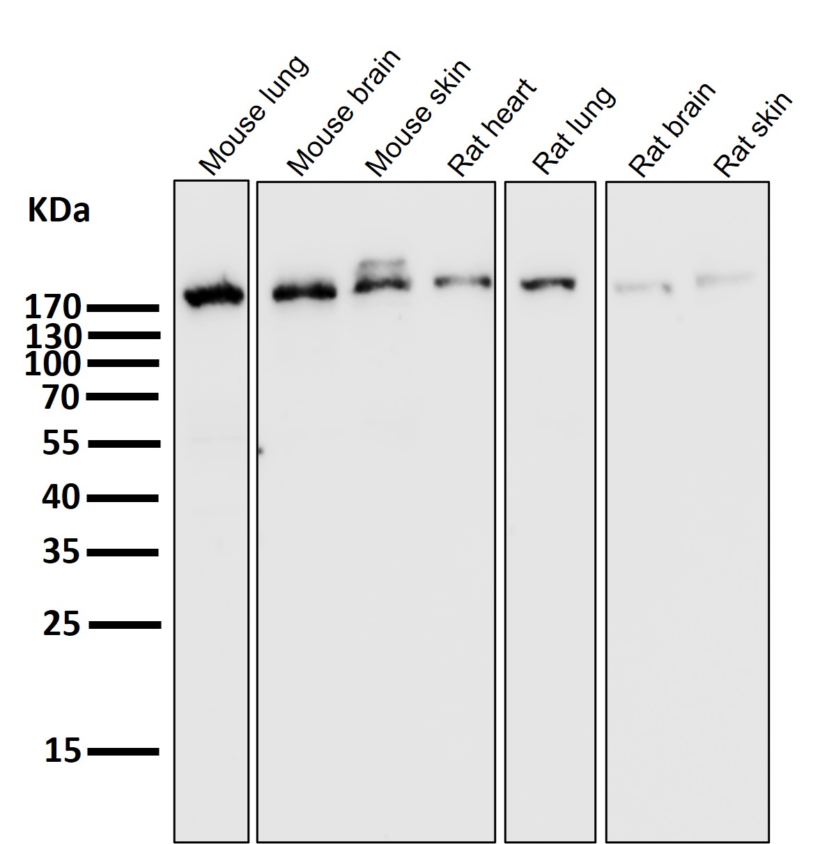 EGFR Ab