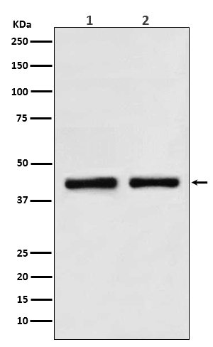 SMARCB1 Ab