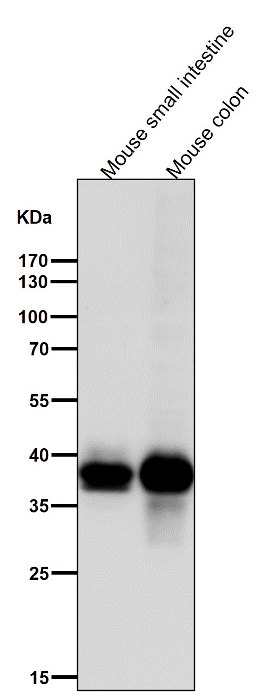 CDX2 Ab